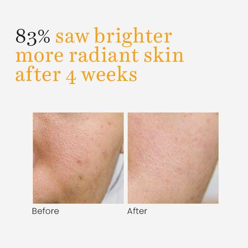O3+ Skin SoLutions Vitamin C Serum Glow With Glycolic Acid (30ml)