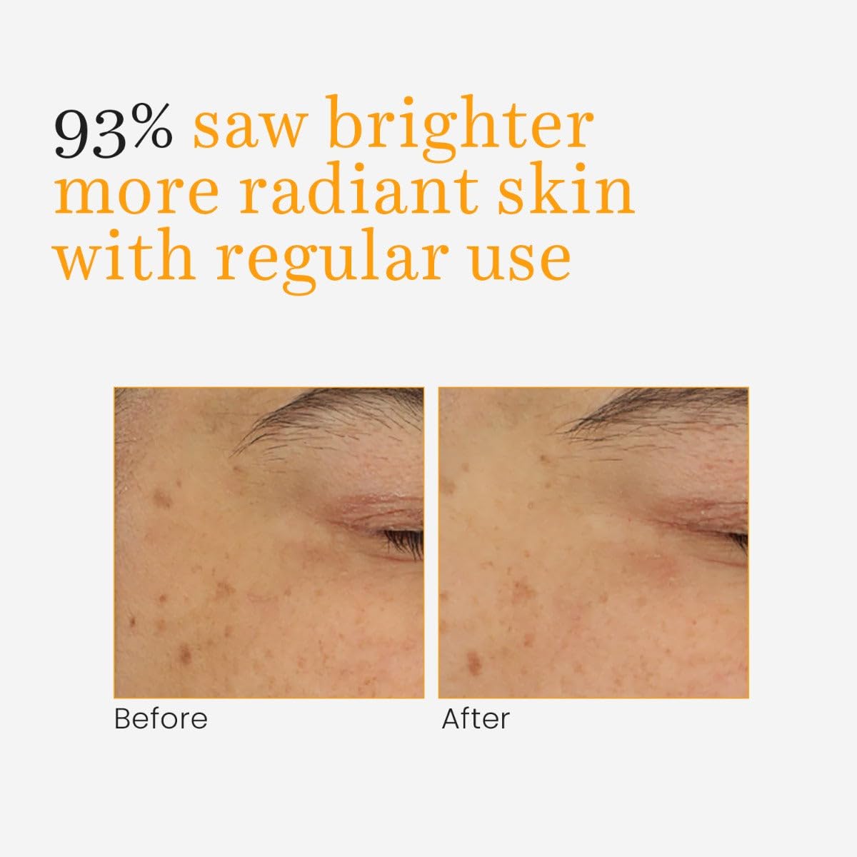 O3+ Vitamin- C & Turmeric Gel Cream For Glow And Moisturised Skin (50 g)
