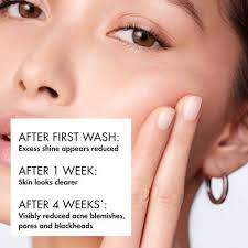 VICHY Laboratoires Normaderm PhytoAction Salicylic Acid Gel Cleanser Face Wash for Oily Skin