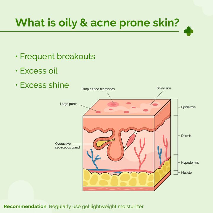 The Drema Co 5% Nia-Ceramide Mattifying Moisturizer with 5% Niacinamide & 2% Ceramide (100 g)
